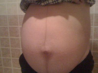 怀孕8个月怀女宝宝的肚型，你出现了几个?