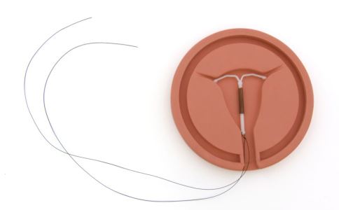 女性绝经后需要取出避孕环吗 为了健康要取出