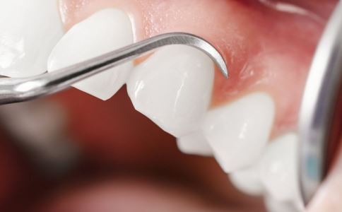 孕前牙齿的检查项目有哪些 要注意什么