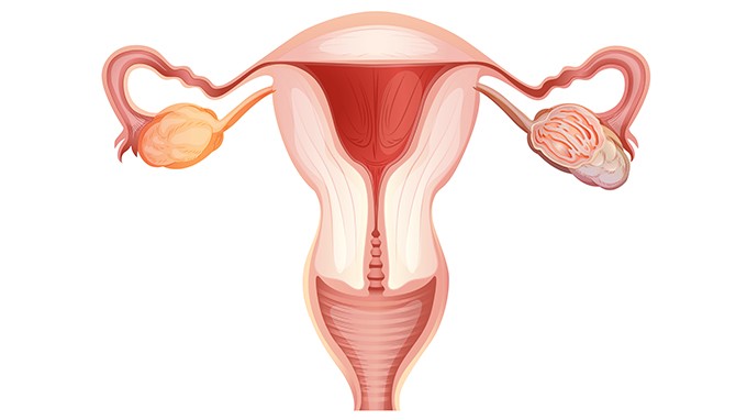 卵巢癌有什么危害
