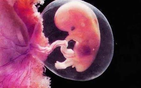 胎儿畸形是什么原因造成的？该如何避免？